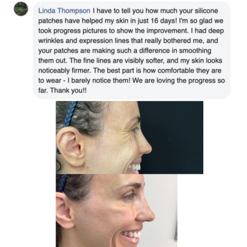 DermaPatch™ Hautglättende Wundpflaster