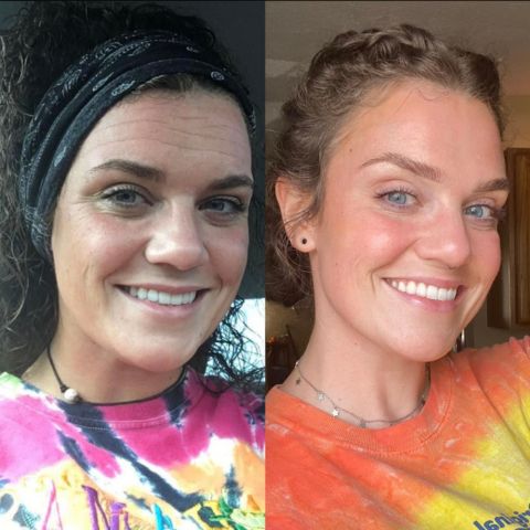 DermaPatch™ Hautglättende Wundpflaster